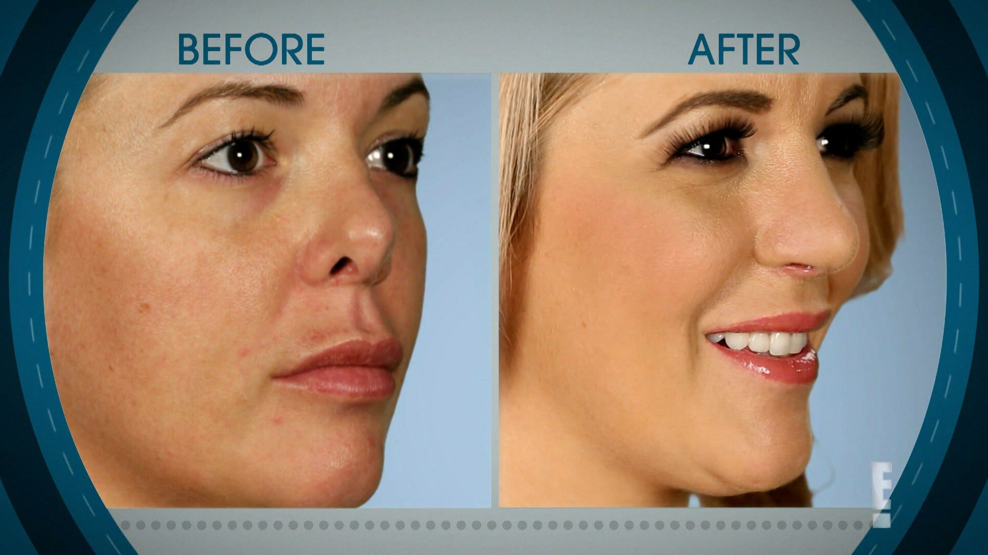 Watch Botched Season 6 (2023) Online OSN+